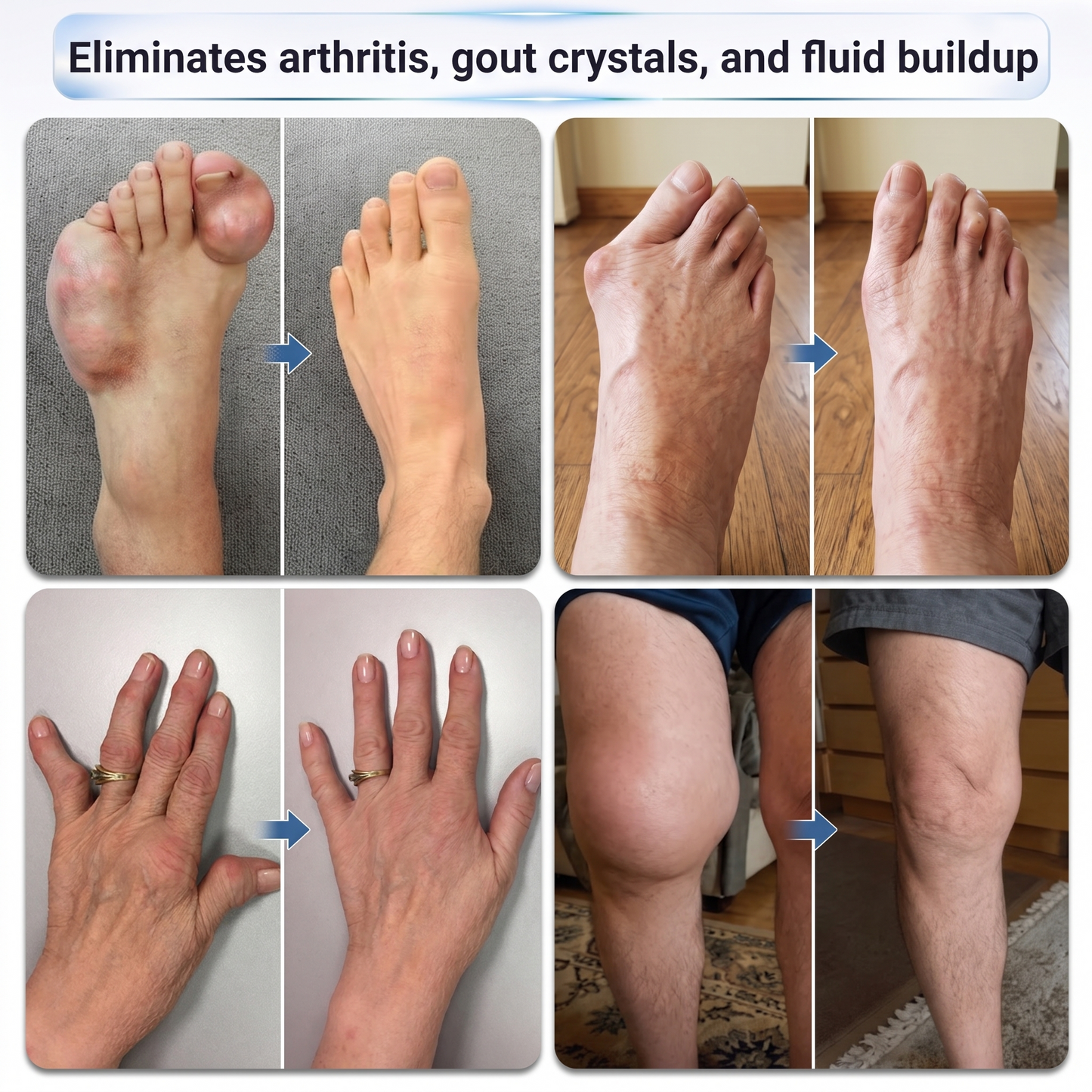 𝐃𝐫.𝐄𝐫𝐚® 💠 𝟬.𝟬𝟱𝗺𝗺 𝐌𝐢𝐜𝐫𝗼𝗻𝗲𝗲𝙙𝙡𝙚 𝑩𝒐𝒏𝒆 & 𝐉𝐨𝗶𝗻𝘁 𝗥𝗼𝗹𝗹𝒆𝙧⚕️