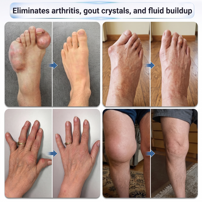 𝐃𝐫.𝐄𝐫𝐚® 💠 𝟬.𝟬𝟱𝗺𝗺 𝐌𝐢𝐜𝐫𝗼𝗻𝗲𝗲𝙙𝙡𝙚 𝑩𝒐𝒏𝒆 & 𝐉𝐨𝗶𝗻𝘁 𝗥𝗼𝗹𝗹𝒆𝙧⚕️
