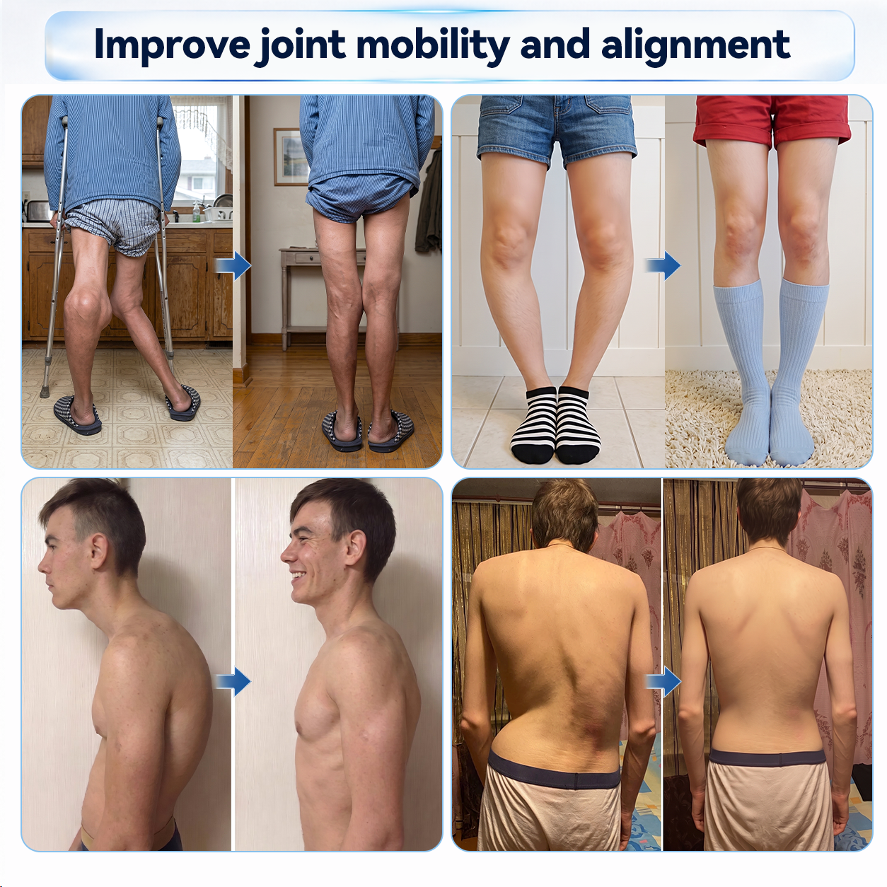 𝐃𝐫.𝐄𝐫𝐚® 💠 𝟬.𝟬𝟱𝗺𝗺 𝐌𝐢𝐜𝐫𝗼𝗻𝗲𝗲𝙙𝙡𝙚 𝑩𝒐𝒏𝒆 & 𝐉𝐨𝗶𝗻𝘁 𝗥𝗼𝗹𝗹𝒆𝙧⚕️