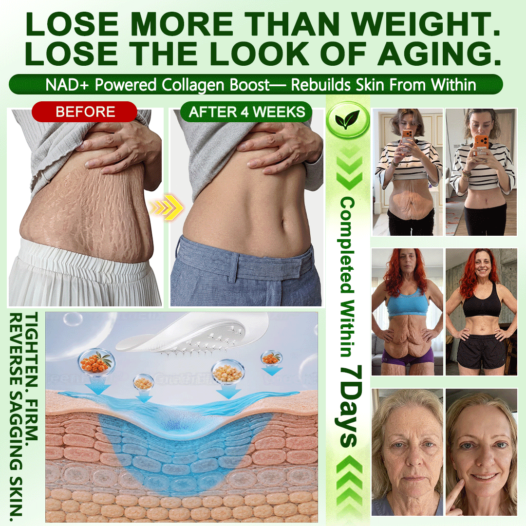 𝑶𝒇𝒇𝒊𝒄𝒊𝒂𝒍 𝑺𝒕𝒐𝒓𝒆 | 𝐍𝐞𝐰!🍀🍀𝐆𝐫𝐞𝐞𝐧𝐅𝐞𝐞𝐥® 𝐌𝐨𝐫𝐢𝐧𝐠𝐚 × 𝐁𝐞𝐫𝐛𝐞𝐫𝐢𝐧𝐞 × 𝐍𝐀𝐃+ 𝟏𝟎-𝐢𝐧-𝟏 𝐍𝐚𝐧𝐨 𝐌𝐢𝐜𝐫𝐨𝐧𝐞𝐞𝐝𝐥𝐞 𝐍𝐮𝐭𝐫𝐢𝐭𝐢𝐨𝐧 𝐏𝐚𝐭𝐜𝐡 🇺🇸 (𝐉𝐮𝐬𝐭 𝐨𝐧𝐜𝐞 𝐚 𝐝𝐚𝐲, 𝐯𝐢𝐬𝐢𝐛𝐥𝐞 𝐜𝐡𝐚𝐧𝐠𝐞𝐬 𝐢𝐧 𝟕 𝐝𝐚𝐲𝐬）𝘽𝙚𝙧𝙗𝙚𝙧𝙞𝙣𝙚 + 𝙈𝙤𝙧𝙞𝙣𝙜𝙖 𝙁𝙤𝙧𝙢𝙪𝙡𝙖 ✅ 𝐅𝐨𝐫 𝐨𝐛𝐞𝐬𝐢𝐭𝐲, 𝗟𝗼𝗼𝘀𝗲 𝘀𝗸𝗶𝗻,𝐝𝐢𝐚𝐛𝐞𝐭𝐞𝐬, 𝐬𝐥𝐞𝐞𝐩 𝐚𝐩𝐧𝐞𝐚, 𝐣𝐨𝐢𝐧𝐭 𝐢𝐬𝐬𝐮𝐞𝐬, 𝐚𝐧𝐝 𝐦𝐨𝐫𝐞💯💯